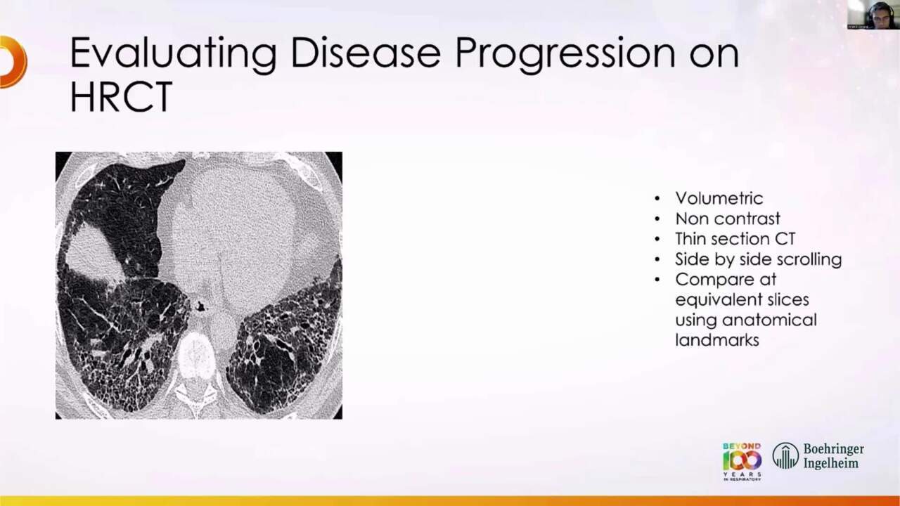 PC-TH-104742-thumbnail