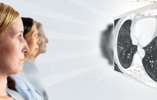 FACE PULMONARY FIBROSIS HEAD ON