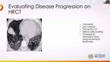 PC-TH-104742-thumbnail