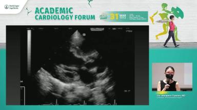 Echo: Thick Heart by Dr.Waraporn